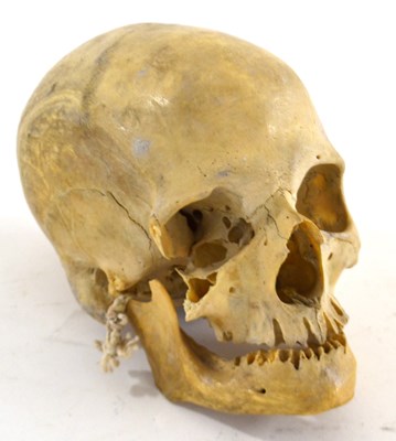 Lot 213 - An anatomical human skull with jaw (missing...